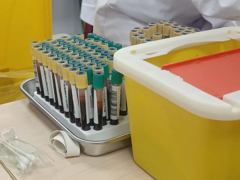 Blood test samples for an ESR test