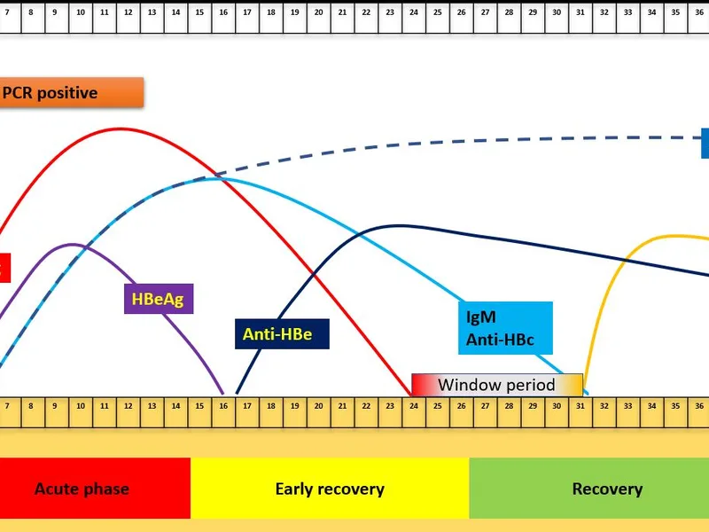 Hepatitis B serology chart showing HBsAg and antibody markers over time